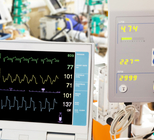 מכונת לב ריאה - תמונת אווירה